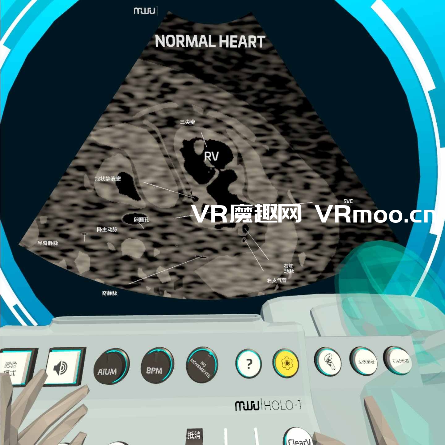 Oculus Quest 医学《心脏病医学VR汉化版》Fetal Heart VR