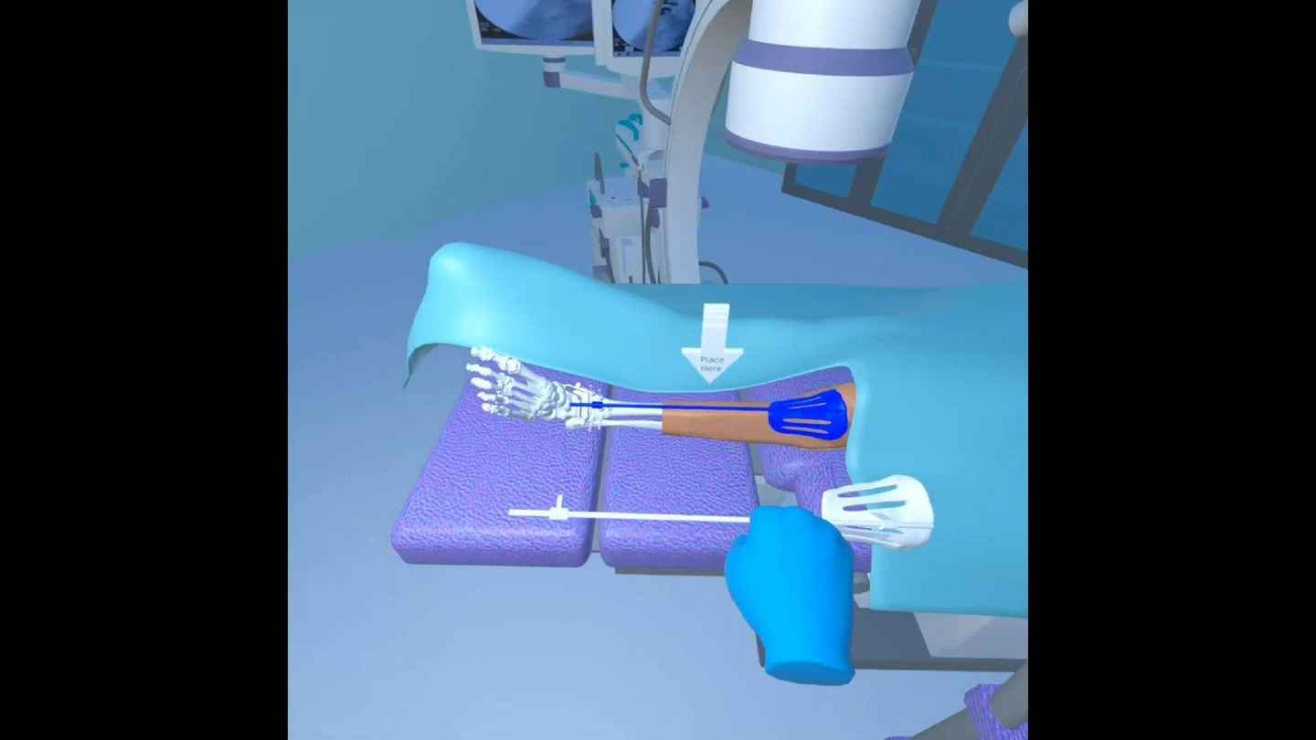 Oculus Quest 游戏《3d手术》3d surgical