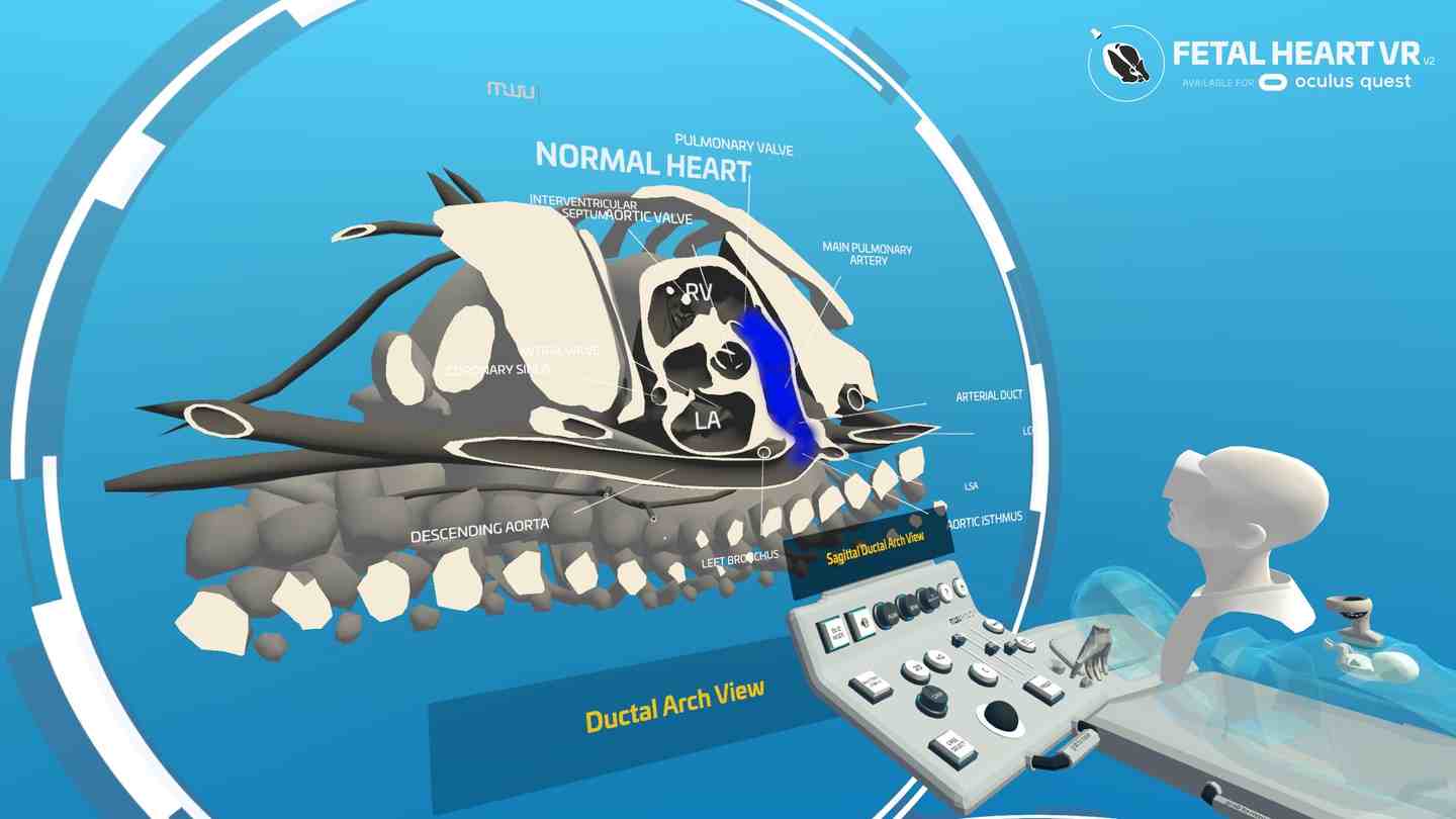 Oculus Quest 游戏《心脏病医学VR》Fetal Heart VR