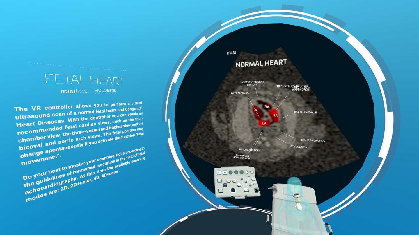 Oculus Quest 游戏《心脏病医学VR》Fetal Heart VR